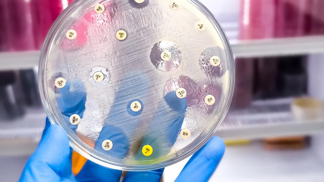 laboratory image of antibiotic susceptibility test