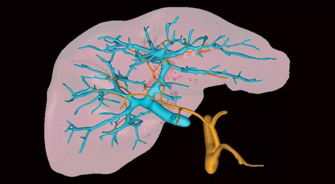 Liver-Transplant-690&#215;380