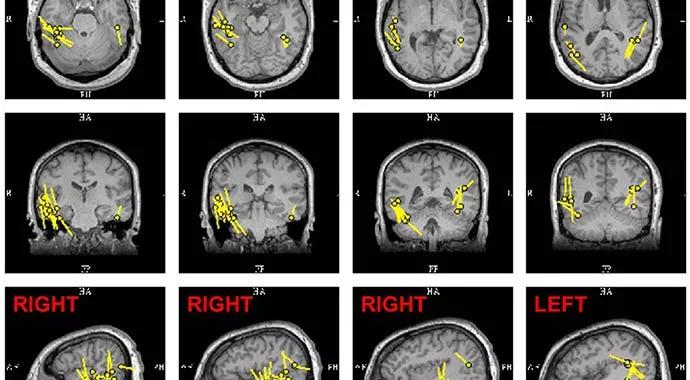 Case-Study-690&#215;380