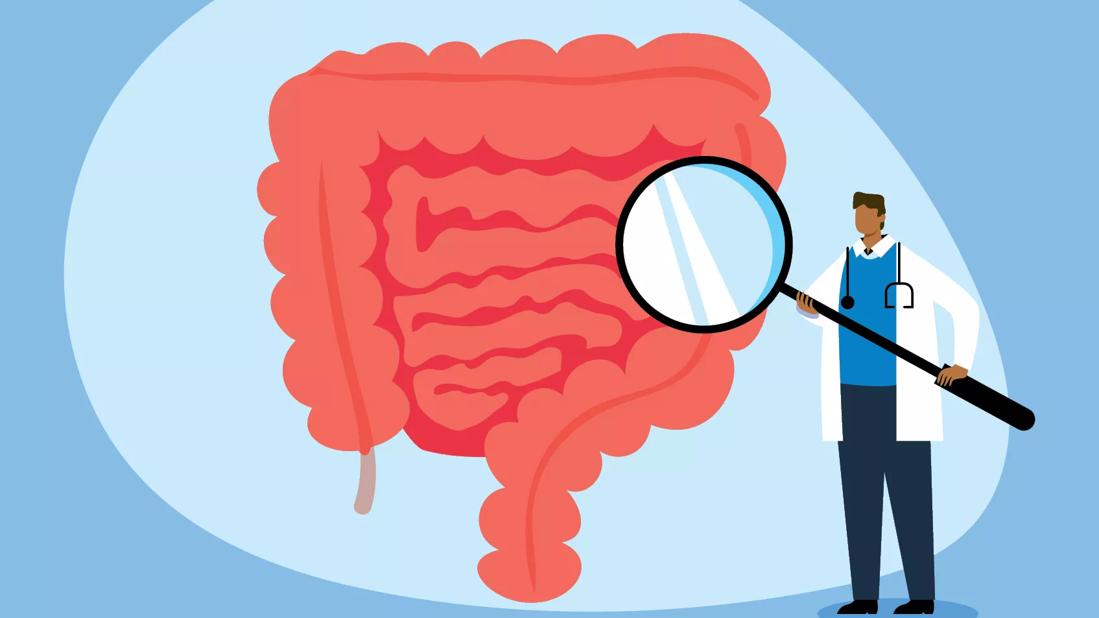 An illustrated person holds up a magnifying glass to a graphic of someone's intestines.