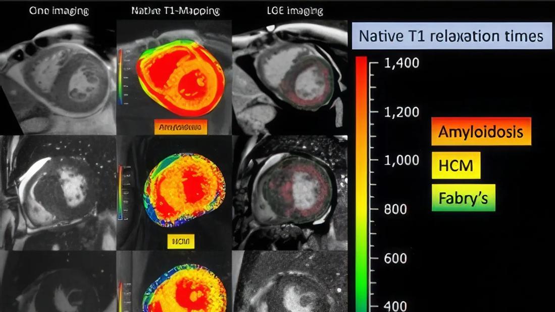 Cardiac Imaging