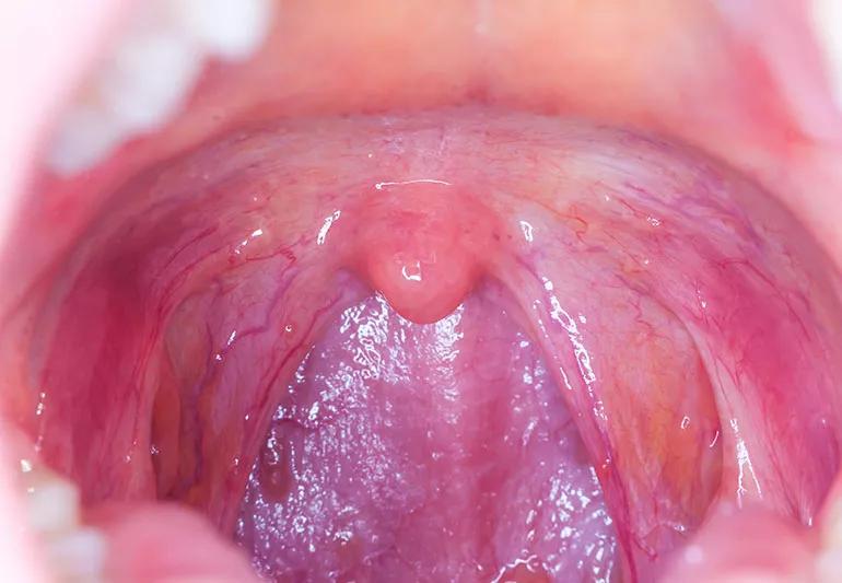 human throat