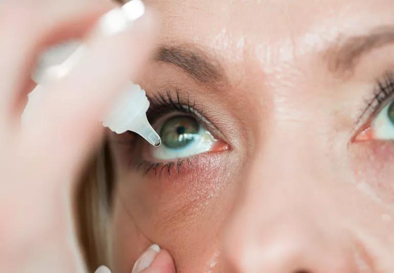 Woman using eye drops to relieve dry eyes