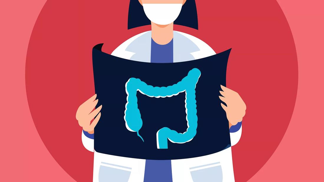 An illustration of a doctor holding an image of a colon