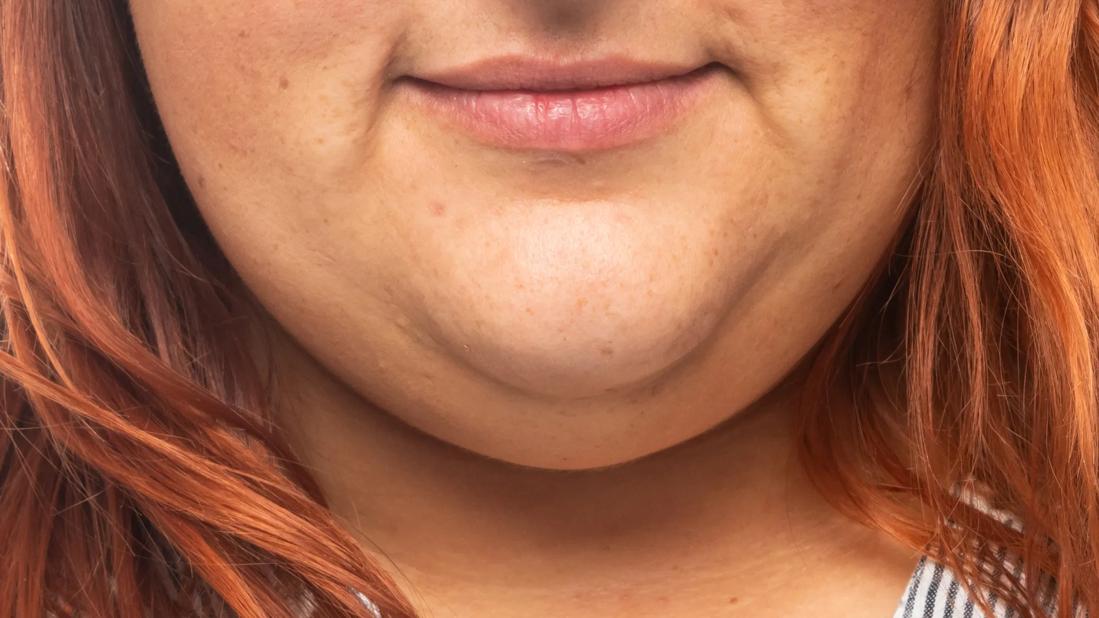 Smiling person with double chin