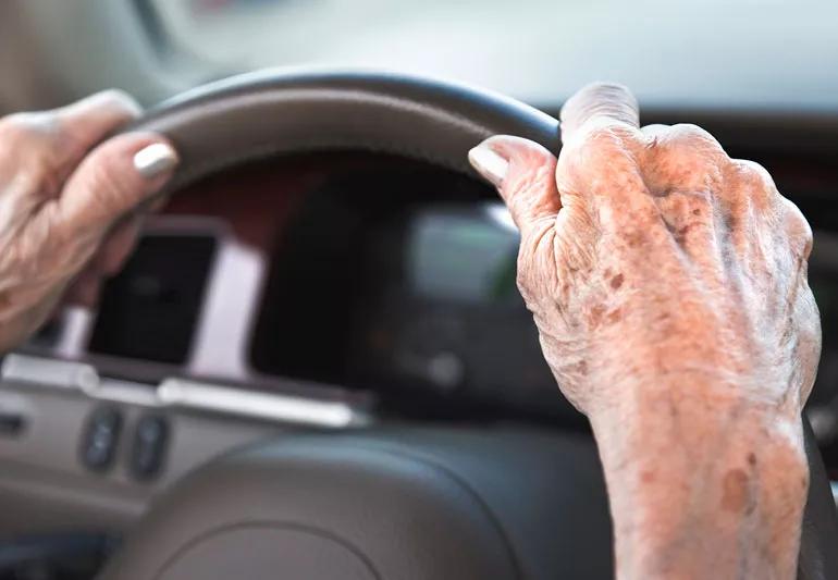 Elderly woman driving car with arthritic hands