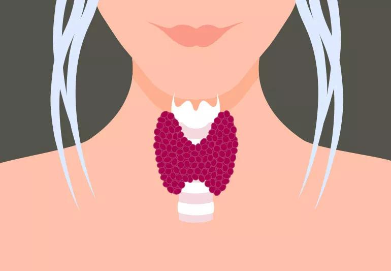 Illustration of older womans neck and her thyroid