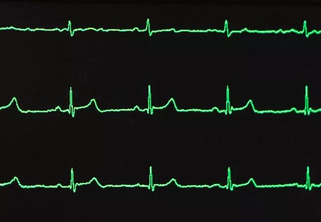 EKG_650-x450