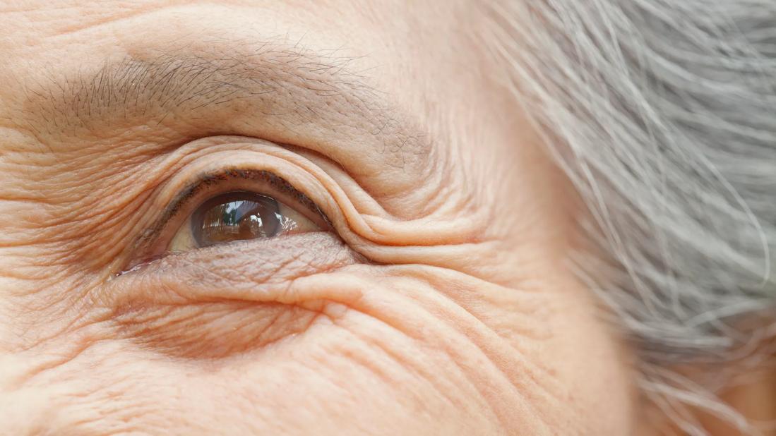 Close-up of older person's eye and heavily wrinkled skin around it