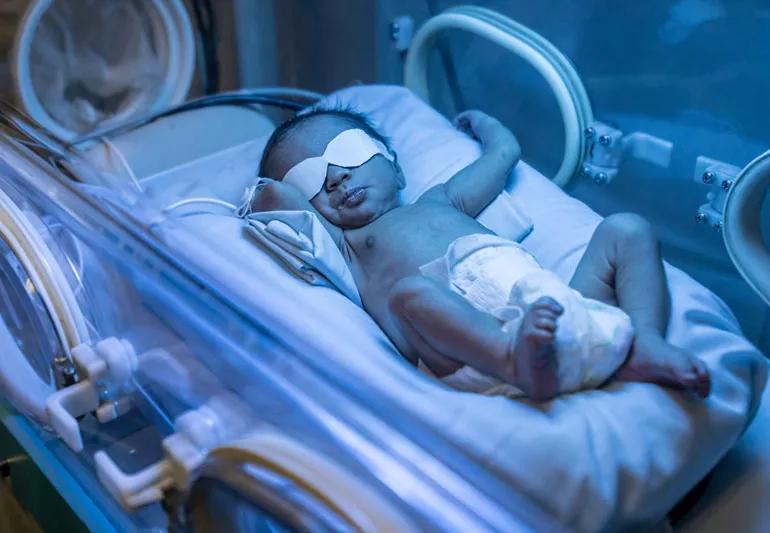 baby being treated for jaundice under lights
