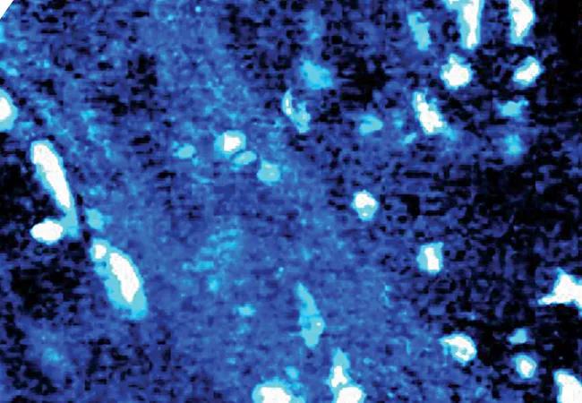 Probe-Based Confocal Light Endomicroscopy and the Optical Biopsy