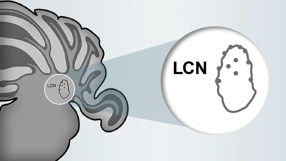 brain illustration with a focused inset section labeled "LCN"