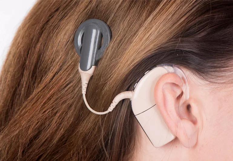 Woman with cochlear implant
