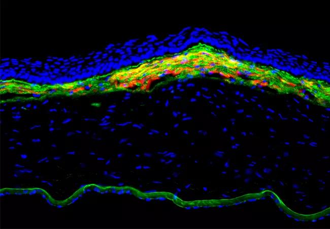 22-EYE-2826711 CQD_fig 1_Cornea Service &#8211; Grants_650x450_hero