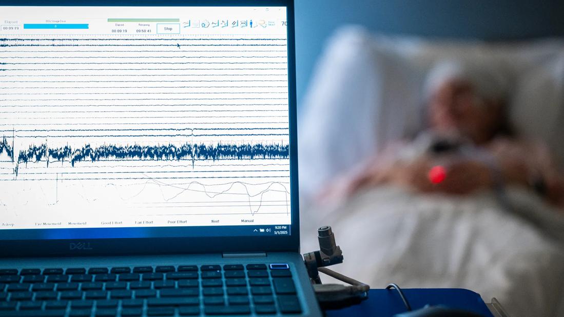 Sleep study