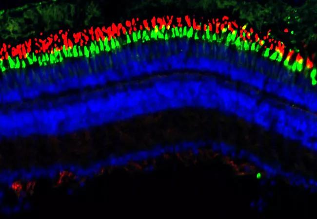 23-EYE-4196362-inflammation-retinal-regeneration-CQD-Hero