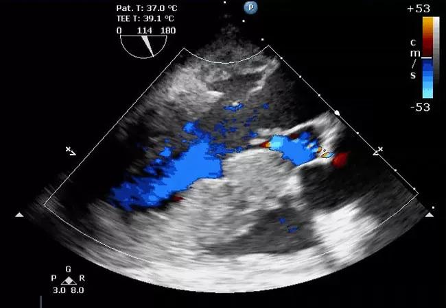 ‘Big Rescue’ Case Study: Unexpected Course of a Hemodynamically Unstable Knee Surgery Patient