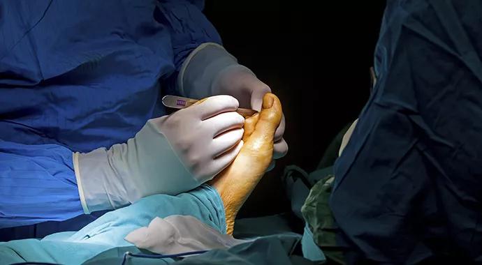 surgery_foot_690x380