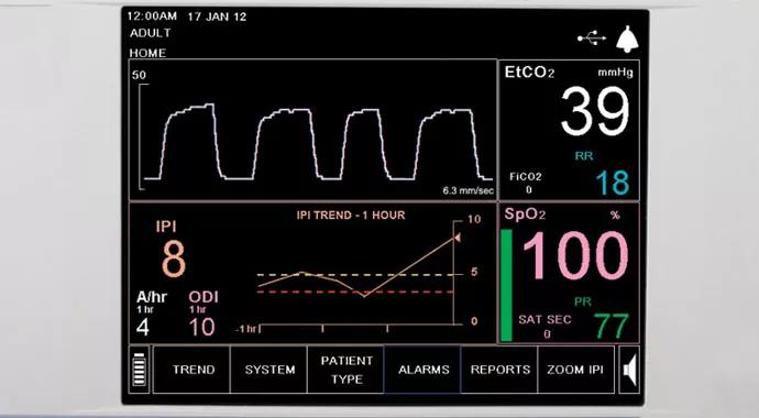 14-DDI-1353 Capnographic Monitoring-690&#215;380