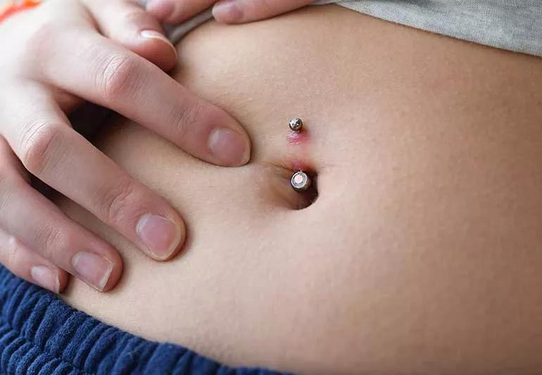 Person with an infected belly button piercing.