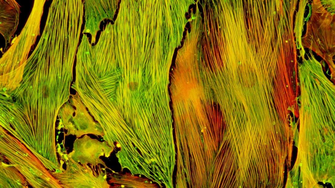 Lung fibroblasts isolated from a preclinical model were stimulated with TGF-β to induce myofibroblast differentiation