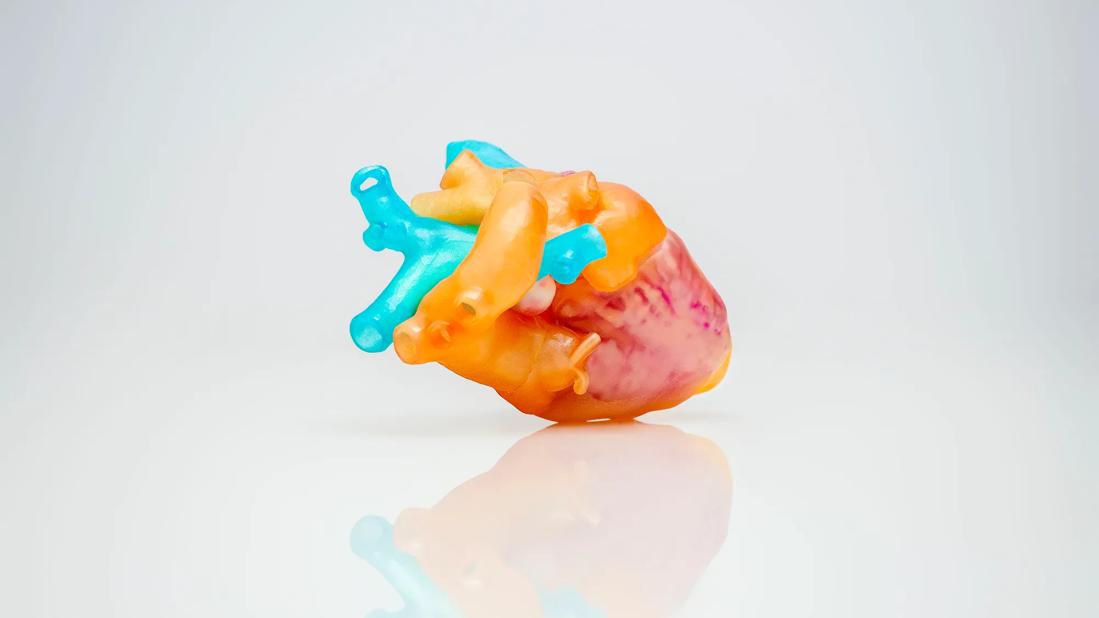 Photograph of 3D-printed patient heart model