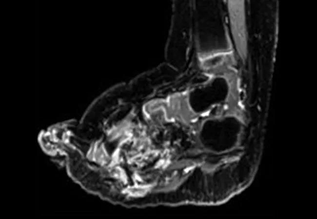 650&#215;450-Selpercatinib-in-Pediatric-Patients-with-RET-Altered-Tumors