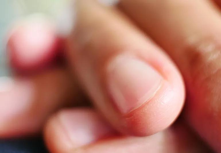 Close-up of hands and nails