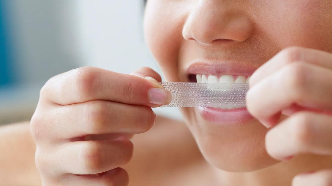 Person applying teeth whitening strip to their teeth