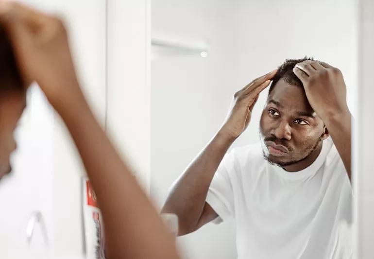 man checking hair loss in mirror