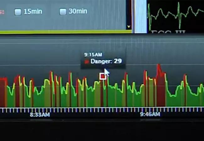 19-HRT-3908-cardiac-telemetry-650&#215;450