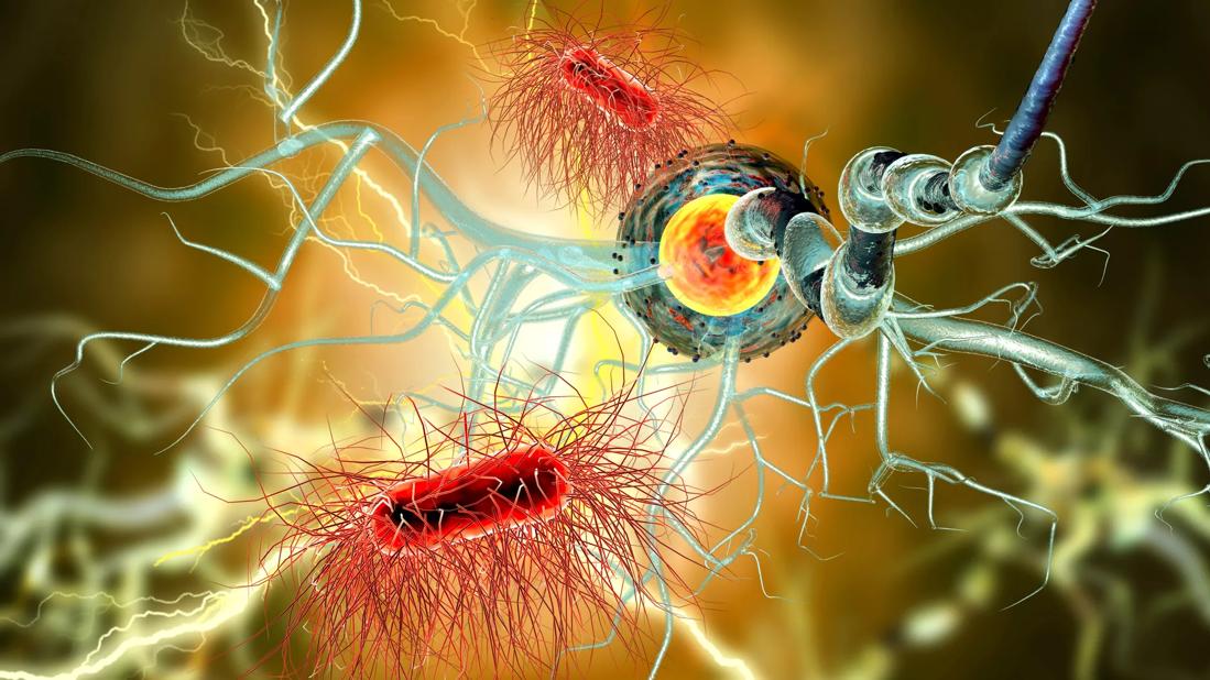 22-NEU-2826663_multiple-sclerosis-650&#215;450
