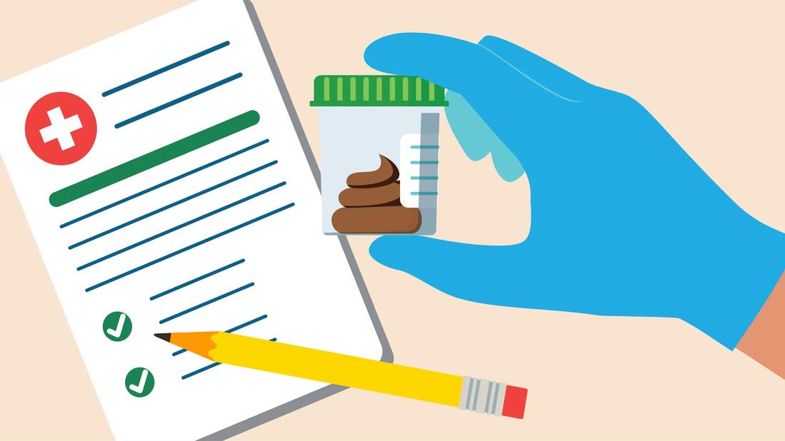 Which Colorectal Cancer Screening Method Is Right for You?