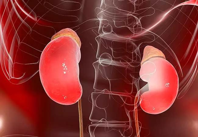 chronic kidney disease