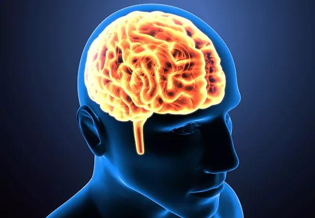 Combo Therapy Stroke Trial Ends One Debate