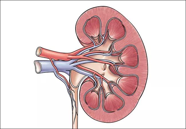 650&#215;450-Renal-Disease