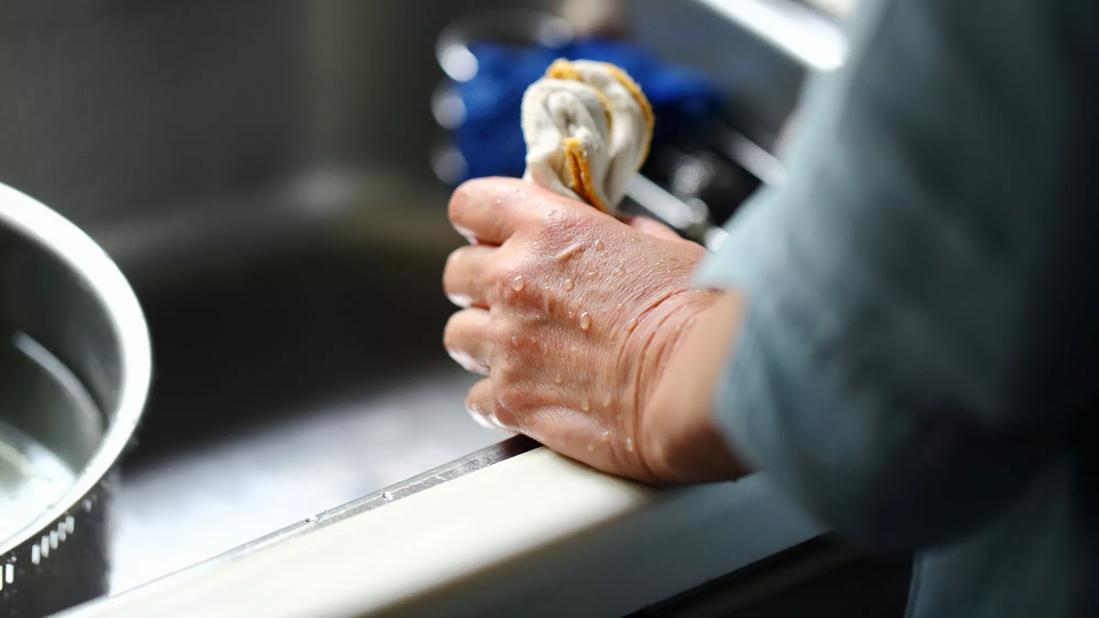 Woman holding a germy kitchen towel