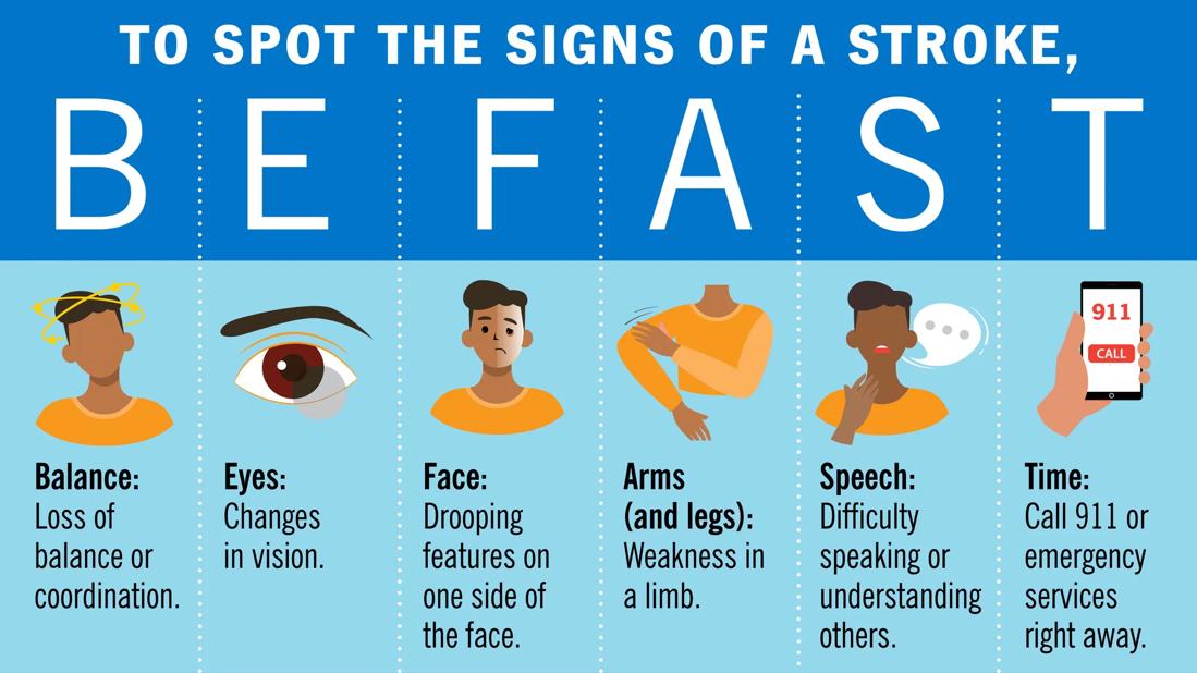 Graphic of stroke signs: BE FAST: Balance, Eyes, Face, Arms, Speech, Time