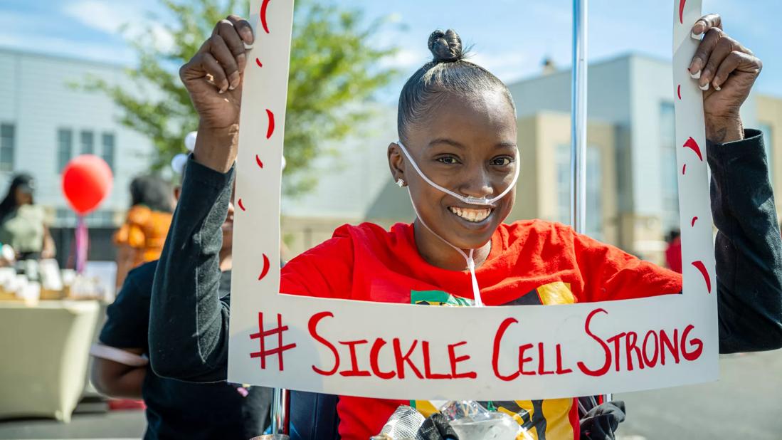 Patient with sickle cell disease