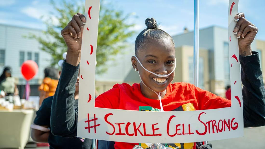 Patient with sickle cell disease