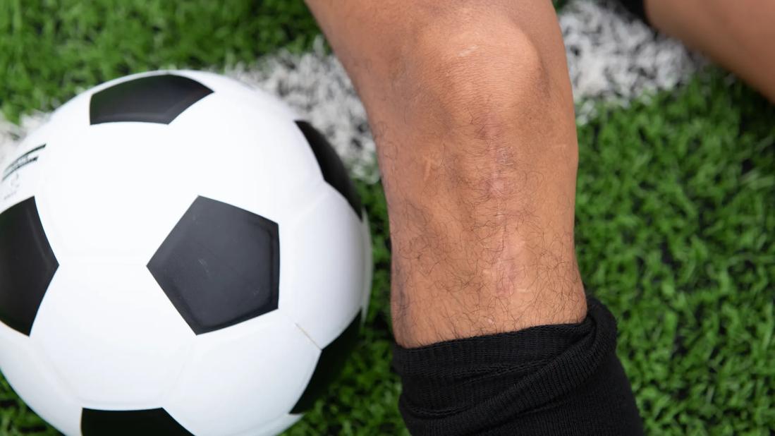 Soccer player with scar from knee surgery