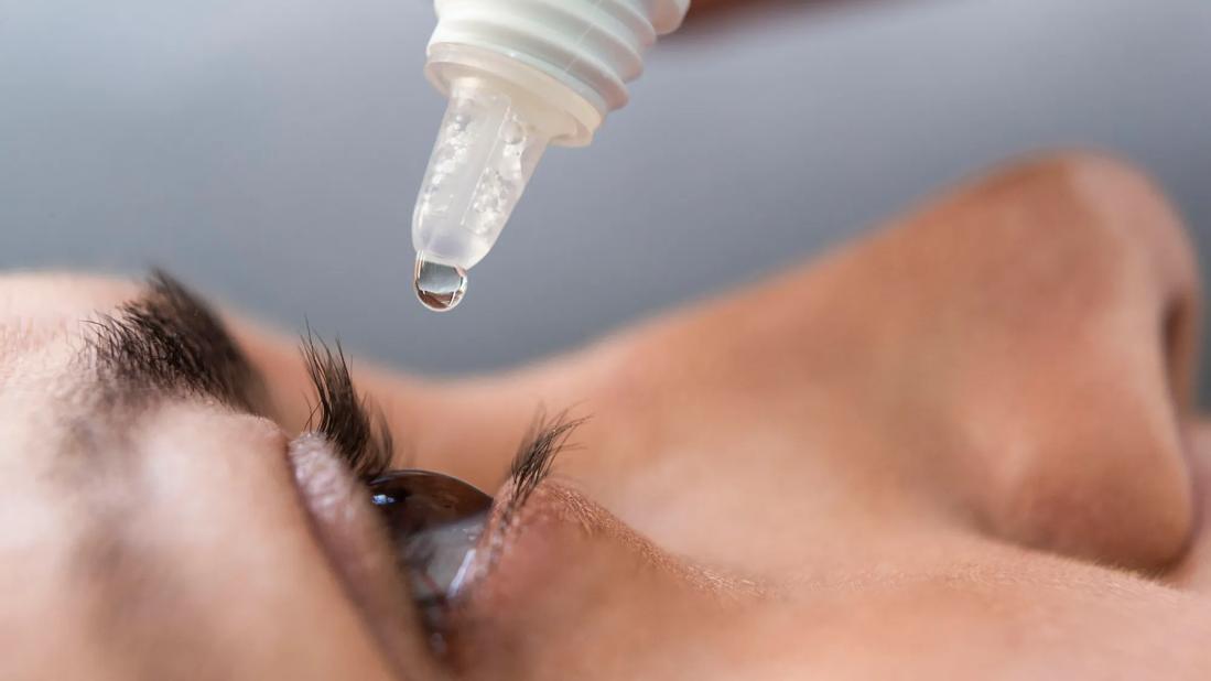 Close-up of face profile, with eye open and eye drops being added to the eye