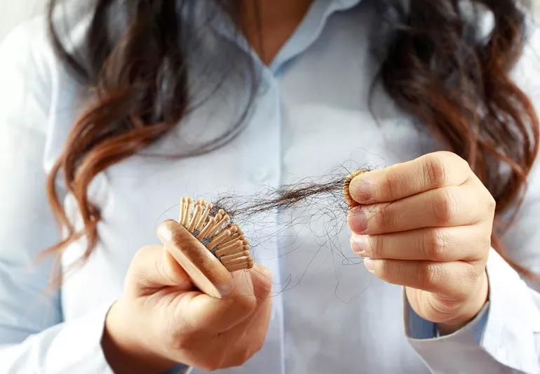 woman with hair loss hair in brush