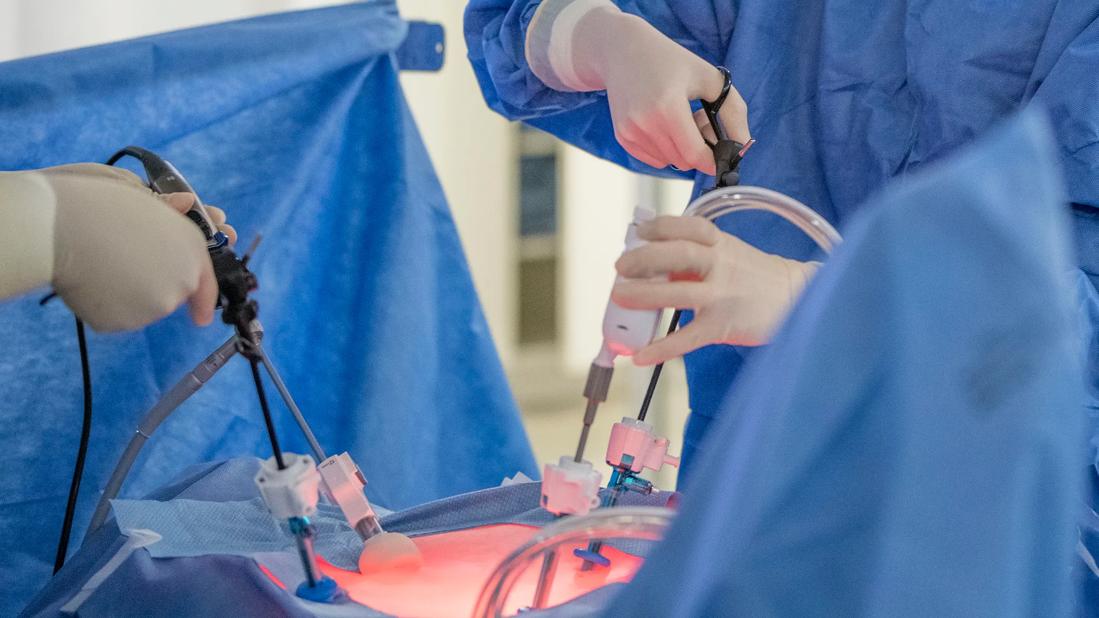 Laparoscopic surgery