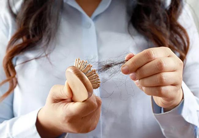 hair loss