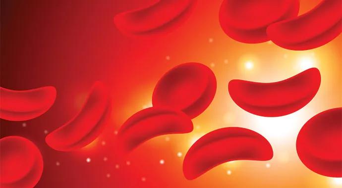 690&#215;380-Sickle-Cell