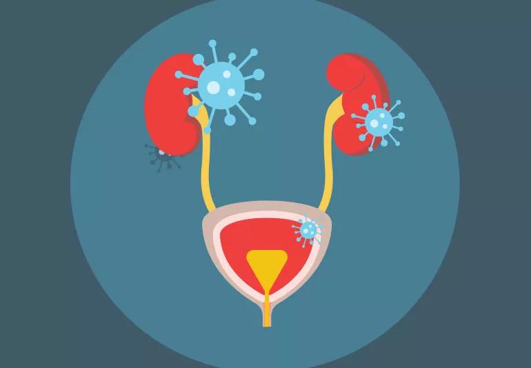 Illustration of a urinary tract infection