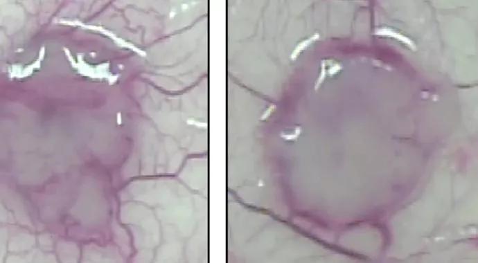 Mouse-tumors-control-(left)-and-VEGF-Ax-690-x-380