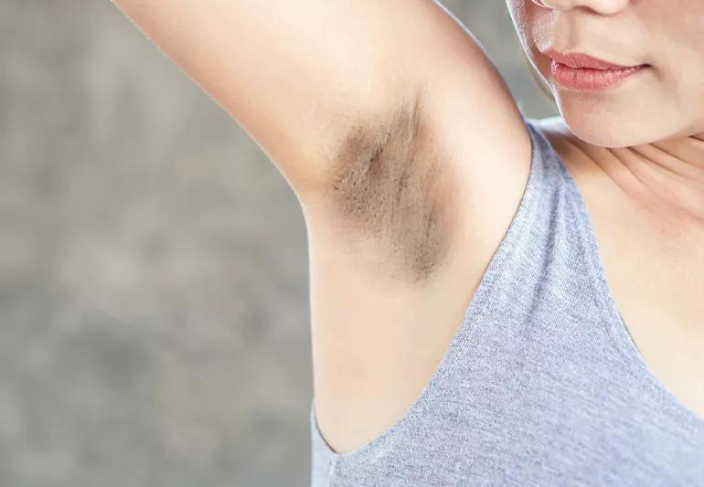 Person holding up arm and looking at dark coloration of armpit.