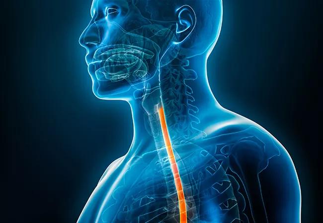 Esophagus or oesophagus 3D rendering illustration close-up with male body contours. Human anatomy, esophagitis, acid reflux, digestive system, medical, biology, science, medicine, healthcare concepts.